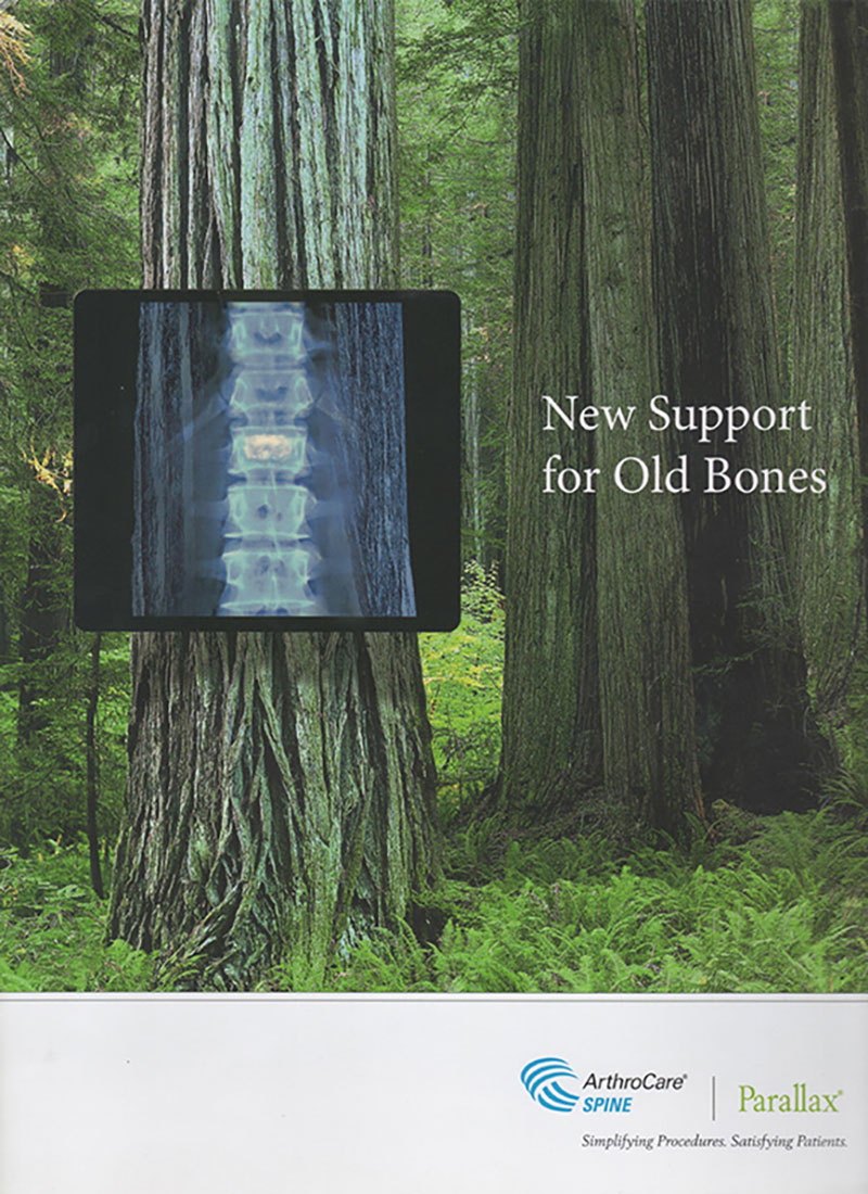 image of ad for Paralax: New Support for Old Bones